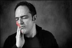 root canal